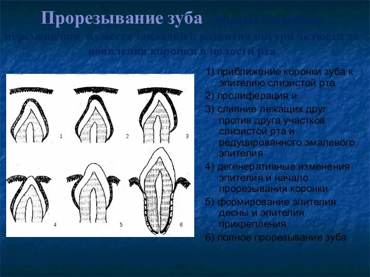 Прорезывание зуба – процесс его осевого перемещения из места закладки