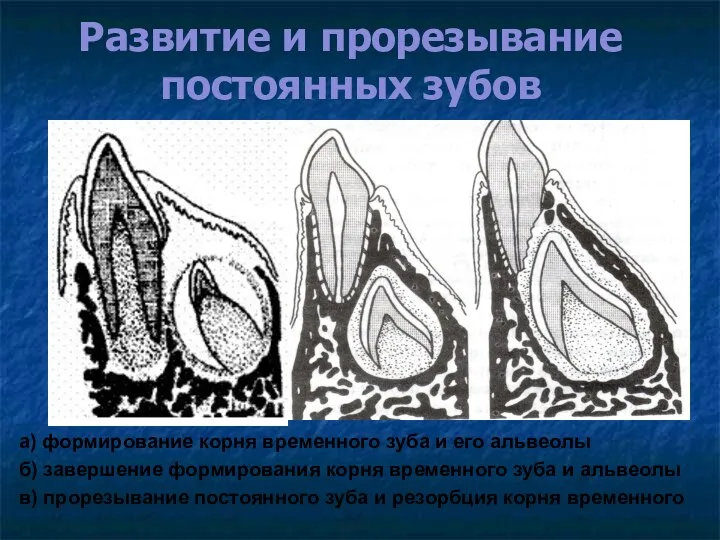 Развитие и прорезывание постоянных зубов а) формирование корня временного зуба и его альвеолы