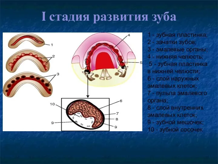 I стадия развития зуба 1 - зубная пластинка; 2 - зачатки зубов; 3