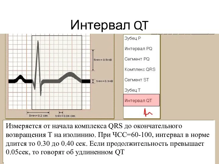 Интервал QT Измеряется от начала комплекса QRS до окончательного возвращения Т на изолинию.
