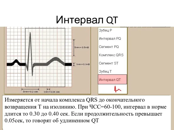 Интервал QT Измеряется от начала комплекса QRS до окончательного возвращения