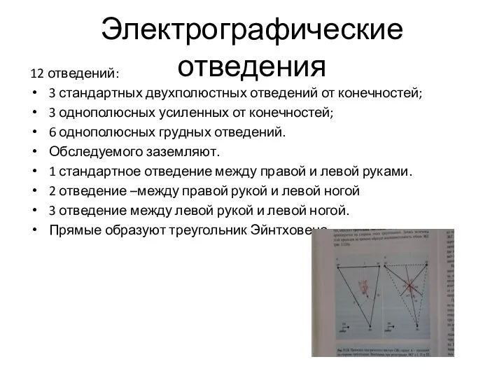 Электрографические отведения 12 отведений: 3 стандартных двухполюстных отведений от конечностей; 3 однополюсных усиленных