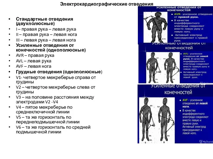 Электрокардиографические отведения Стандартные отведения (двухполюсные) I – правая рука – левая рука II