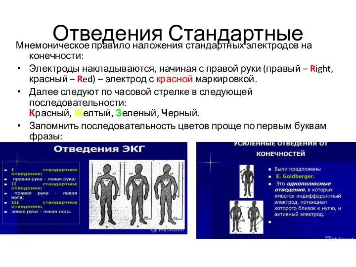 Отведения Стандартные Мнемоническое правило наложения стандартных электродов на конечности: Электроды