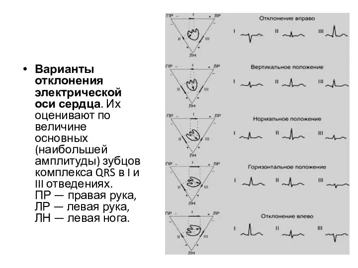 Варианты отклонения электрической оси сердца. Их оценивают по величине основных