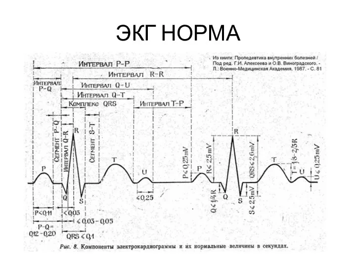 ЭКГ НОРМА