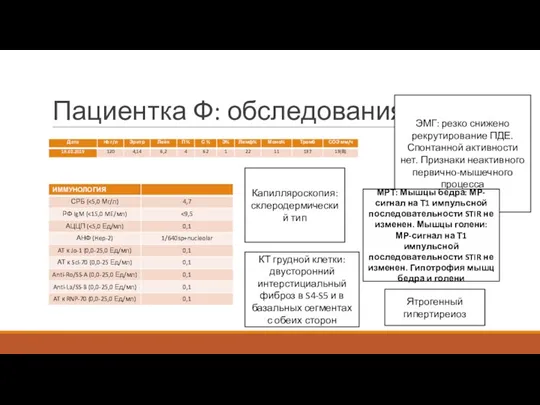 Пациентка Ф: обследования Капилляроскопия: склеродермический тип КТ грудной клетки: двусторонний