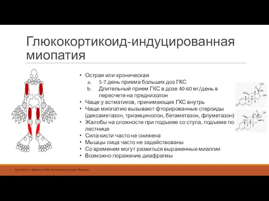 Глюкокортикоид-индуцированная миопатия Foye PM et al. Medscape 2018. Corticosteroid-induced Myopathy