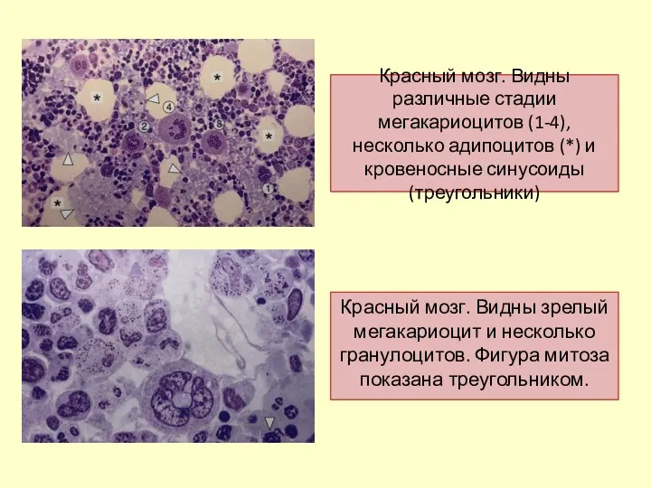 Красный мозг. Видны различные стадии мегакариоцитов (1-4), несколько адипоцитов (*) и кровеносные синусоиды