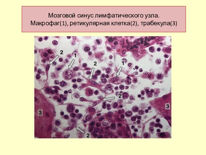 Мозговой синус лимфатического узла. Макрофаг(1), ретикулярная клетка(2), трабекула(3)