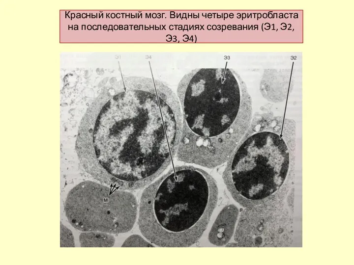 Красный костный мозг. Видны четыре эритробласта на последовательных стадиях созревания (Э1, Э2, Э3, Э4)