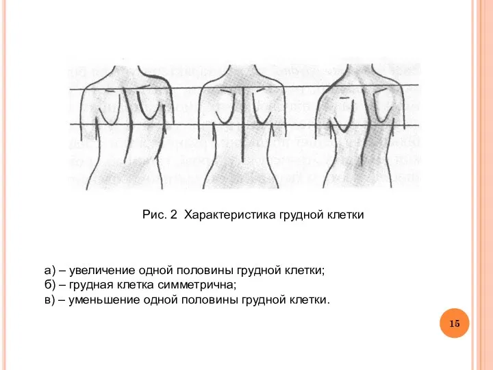 Рис. 2 Характеристика грудной клетки а) – увеличение одной половины