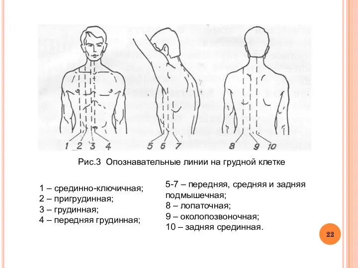 Рис.3 Опознавательные линии на грудной клетке 1 – срединно-ключичная; 2