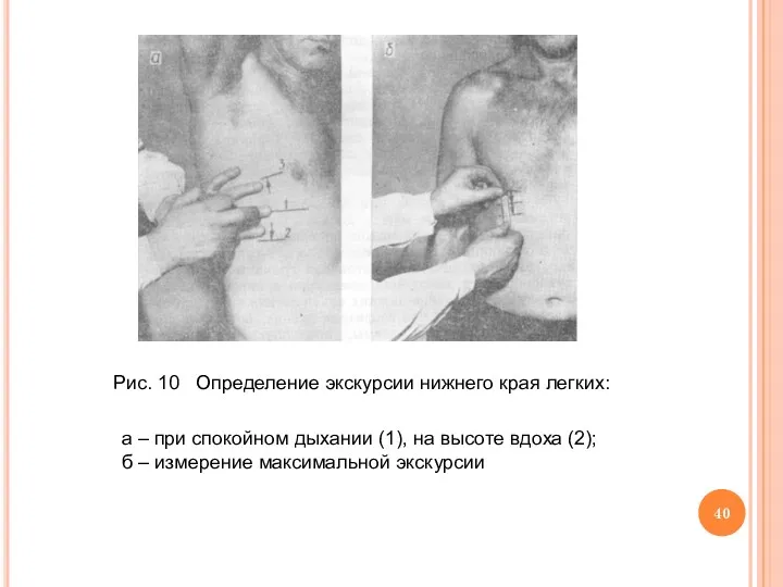Рис. 10 Определение экскурсии нижнего края легких: а – при