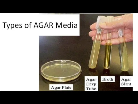 Types of AGAR Media