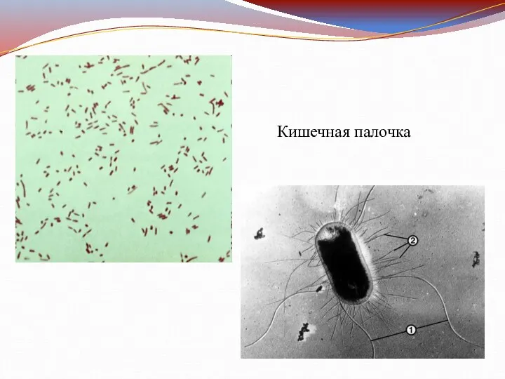 Кишечная палочка