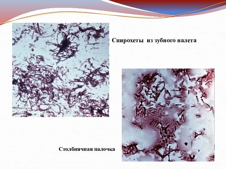 Спирохеты из зубного налета Столбнячная палочка