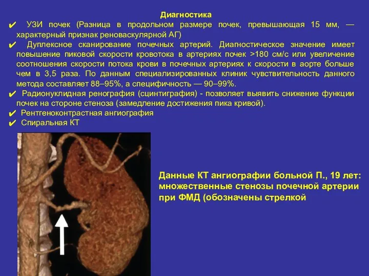 Диагностика УЗИ почек (Разница в продольном размере почек, превышающая 15