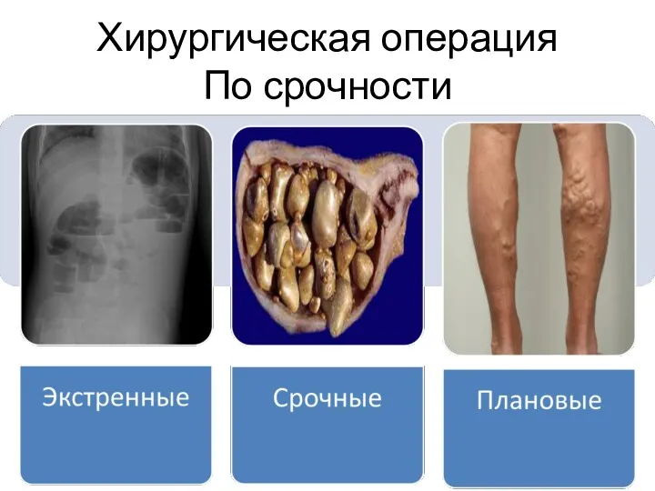 Хирургическая операция По срочности