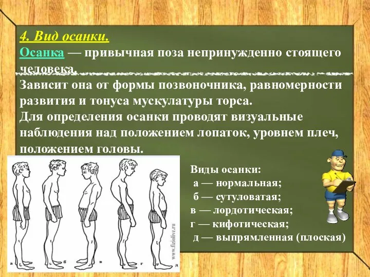 4. Вид осанки. Осанка — привычная поза непринужденно стоящего человека.