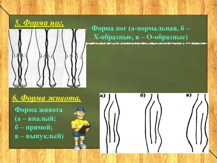 5. Форма ног. Форма ног (а-нормальная, б – Х-образные, в