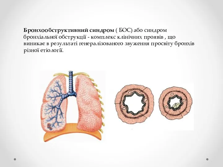 Бронхообструктивний синдром ( БОС) або синдром бронхіальної обструкції - комплекс