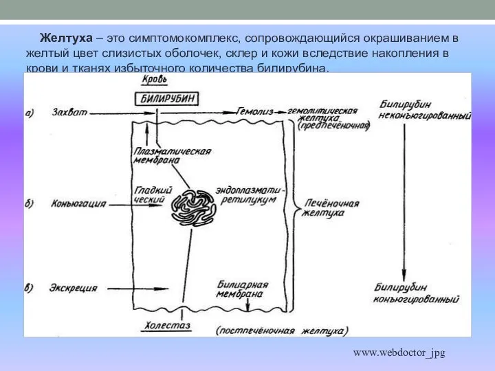 Желтуха – это симптомокомплекс, сопровождающийся окрашиванием в желтый цвет слизистых