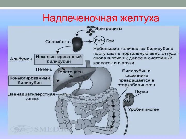 Надпеченочная желтуха