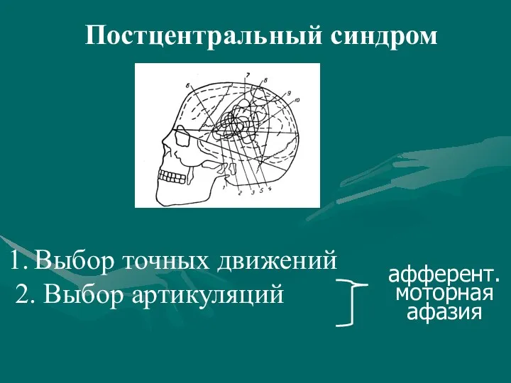 Постцентральный синдром Выбор точных движений 2. Выбор артикуляций афферент. моторная афазия