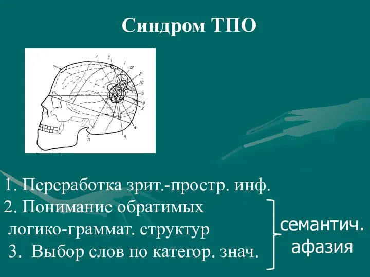 Синдром ТПО Переработка зрит.-простр. инф. Понимание обратимых логико-граммат. структур 3.