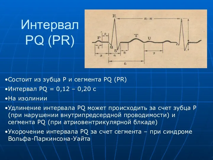 Интервал PQ (PR) Состоит из зубца P и сегмента PQ (PR) Интервал PQ