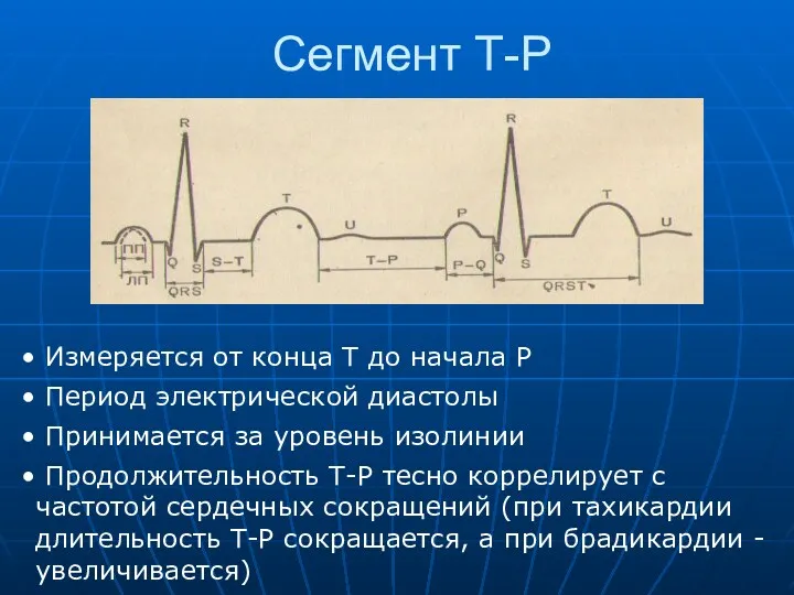 Сегмент Т-Р Измеряется от конца Т до начала Р Период электрической диастолы Принимается