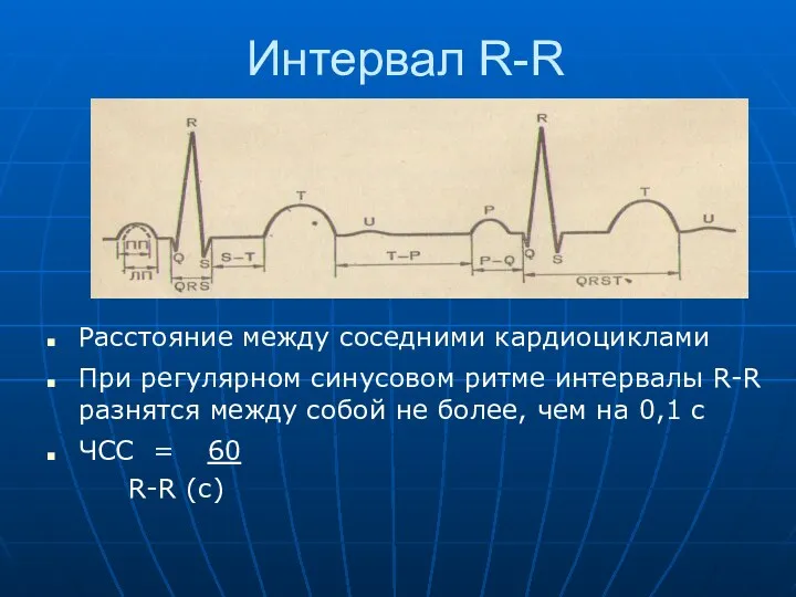 Интервал R-R Расстояние между соседними кардиоциклами При регулярном синусовом ритме интервалы R-R разнятся