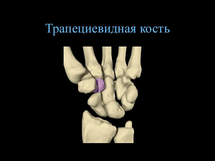 Трапециевидная кость