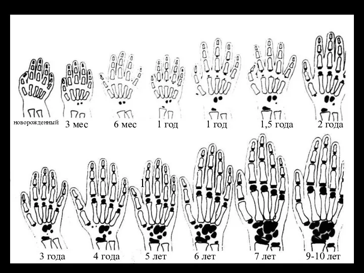 1 новорожденный 3 мес 6 мес 1 год 1 год 1,5 года 2