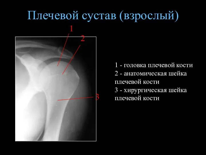 Плечевой сустав (взрослый) 1 - головка плечевой кости 2 - анатомическая шейка плечевой