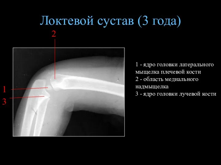 Локтевой сустав (3 года) 1 - ядро головки латерального мыщелка плечевой кости 2