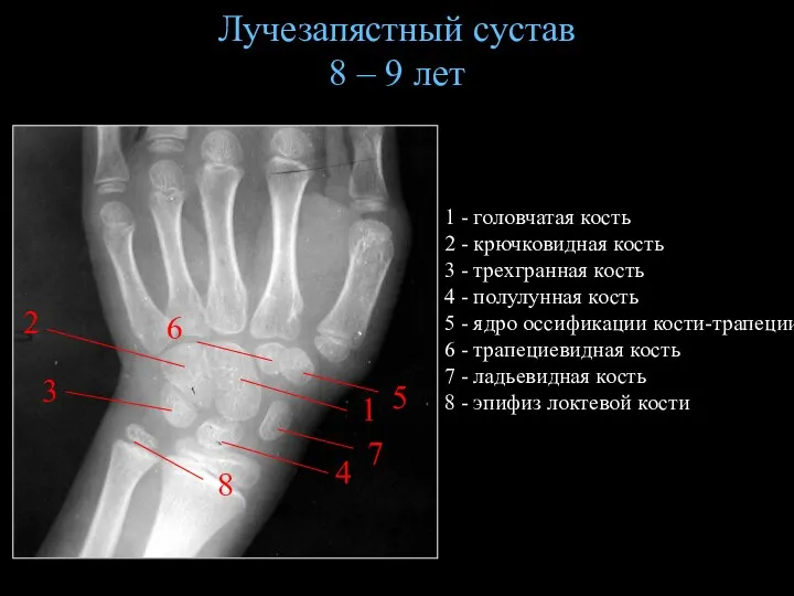 Лучезапястный сустав 8 – 9 лет 1 2 3 1