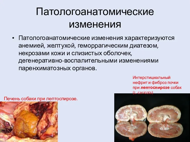 Патологоанатомические изменения Патологоанатомические изменения характеризуются анемией, желтухой, геморрагическим диатезом, некрозами