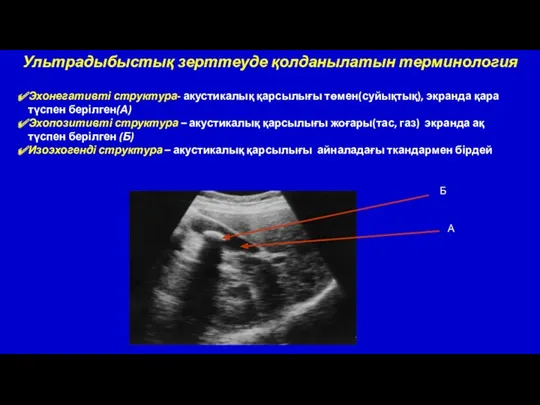 Эхонегативті структура- акустикалық қарсылығы төмен(суйықтық), экранда қара түспен берілген(А) Эхопозитивті