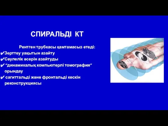 СПИРАЛЬДІ КТ Рентген трубкасы қамтамасыз етеді: Зерттеу уақытын азайту Сәулелік