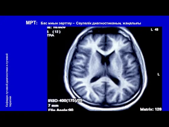 МРТ: Бас миын зерттеу – Сәулелік диагностиканың жаңалығы Кафедра лучевой диагностики и лучевой терапии