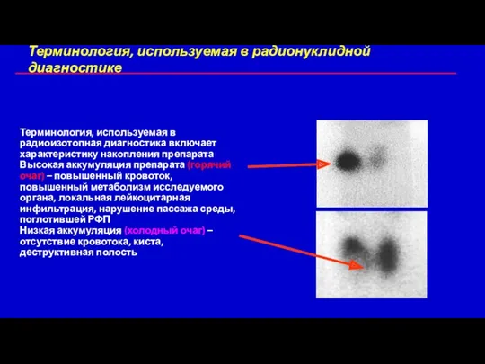 Терминология, используемая в радионуклидной диагностике Терминология, используемая в радиоизотопная диагностика