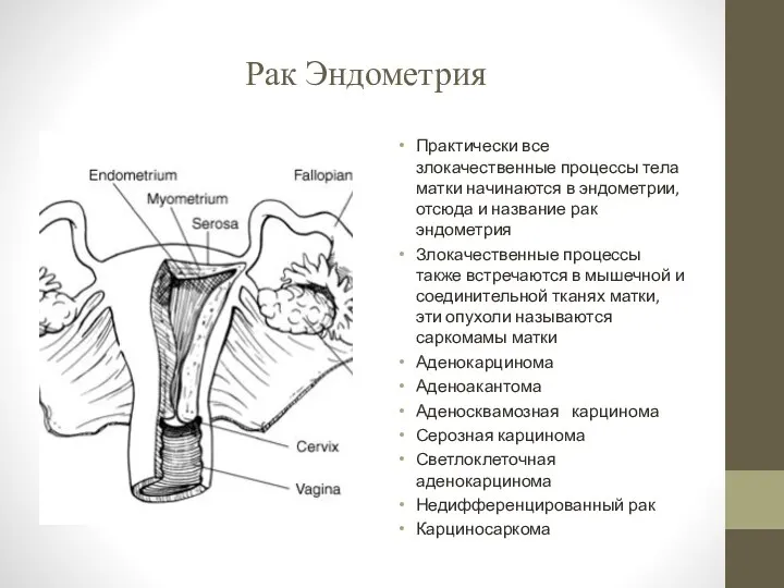 Рак Эндометрия Практически все злокачественные процессы тела матки начинаются в эндометрии, отсюда и