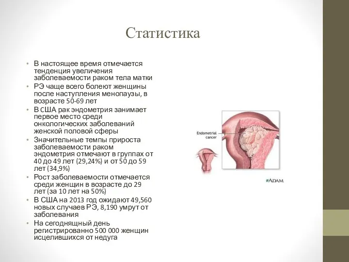 Статистика В настоящее время отмечается тенденция увеличения заболеваемости раком тела