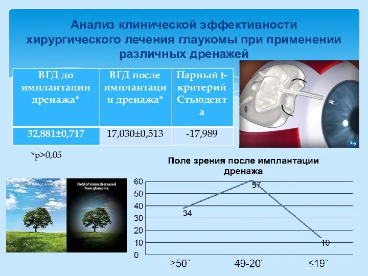 Анализ клинической эффективности хирургического лечения глаукомы при применении различных дренажей *p>0,05