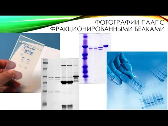 ФОТОГРАФИИ ПААГ С ФРАКЦИОНИРОВАННЫМИ БЕЛКАМИ