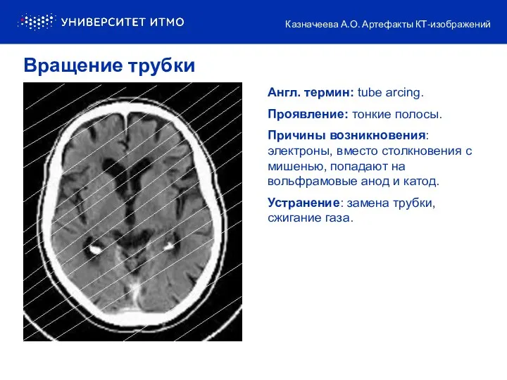 Англ. термин: tube arcing. Проявление: тонкие полосы. Причины возникновения: электроны,