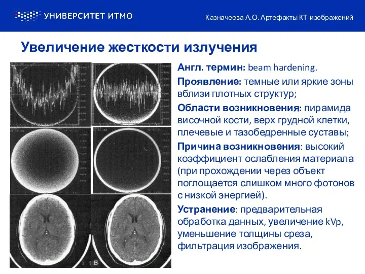 Англ. термин: beam hardening. Проявление: темные или яркие зоны вблизи