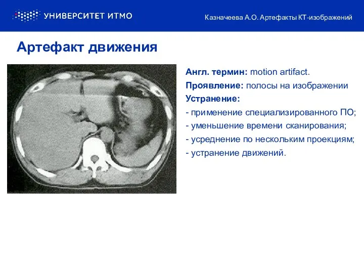 Англ. термин: motion artifact. Проявление: полосы на изображении Устранение: -